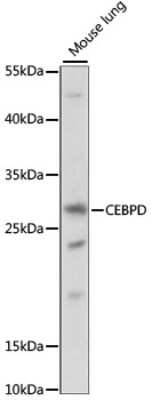 Western Blot: CEBP Delta Antibody [NBP2-92220] - Analysis of extracts of mouse lung, using CEBP Delta at 1:1000 dilution.Secondary antibody: HRP Goat Anti-Rabbit IgG (H+L) at 1:10000 dilution.Lysates/proteins: 25ug per lane.Blocking buffer: 3% nonfat dry milk in TBST.Detection: ECL Basic Kit .Exposure time: 90S.