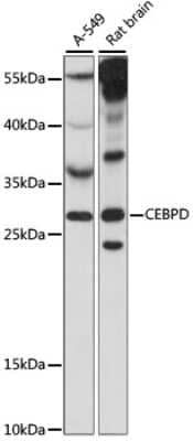 Western Blot: CEBP Delta Antibody [NBP2-92221] - Analysis of extracts of various cell lines, using CEBP Delta at 1:1000 dilution.Secondary antibody: HRP Goat Anti-Rabbit IgG (H+L) at 1:10000 dilution.Lysates/proteins: 25ug per lane.Blocking buffer: 3% nonfat dry milk in TBST.Detection: ECL Basic Kit .Exposure time: 90S.