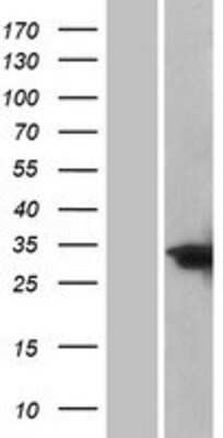 Western Blot CEBP Delta Overexpression Lysate