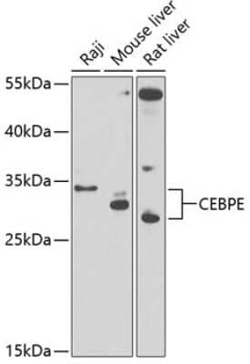 Western Blot: CEBP epsilon Antibody [NBP2-92732] - Analysis of extracts of various cell lines, using CEBP epsilon at 1:1000 dilution.Secondary antibody: HRP Goat Anti-Rabbit IgG (H+L) at 1:10000 dilution.Lysates/proteins: 25ug per lane.Blocking buffer: 3% nonfat dry milk in TBST.Detection: ECL Basic Kit .Exposure time: 90s.