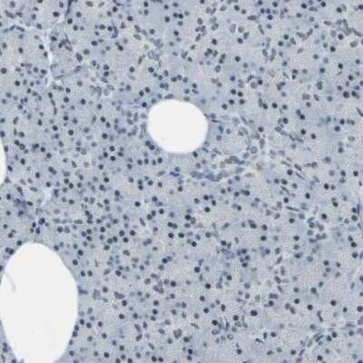 Immunohistochemistry-Paraffin CEBP gamma Antibody