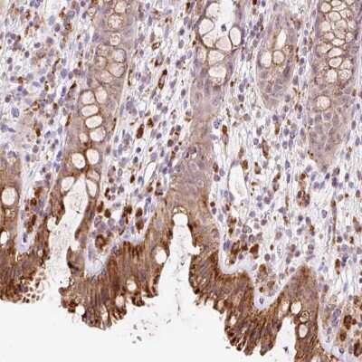 Immunohistochemistry: CEBPZOS Antibody [NBP2-47513] - Staining of human rectum shows strong granular cytoplasmic positivity in glandular cells.