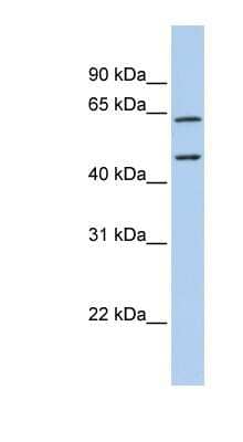 Western Blot Adenosine Deaminase 2/CECR1 Antibody - BSA Free