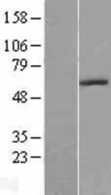 Western Blot: Adenosine Deaminase 2/CECR1 Overexpression Lysate [NBL1-09078] - Left-Empty vector transfected control cell lysate (HEK293 cell lysate); Right -Over-expression Lysate for CECR1.