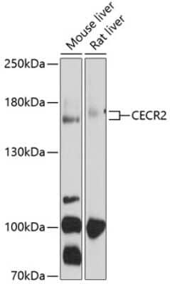 Western Blot: CECR2 Antibody [NBP2-92002] - Analysis of extracts of various cell lines, using CECR2 .Exposure time: 60s.