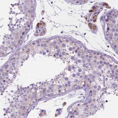 Immunohistochemistry-Paraffin: CECR6 Antibody [NBP2-55867] - Staining of human testis shows moderate cytoplasmic positivity in Leydig cells.