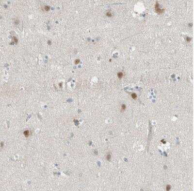 Immunohistochemistry-Paraffin: CEECAM1 Antibody [NBP1-84551] - Staining of human cerebral cortex shows moderate nuclear and cytoplasmic positivity in neuronal cells.
