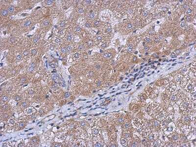 Immunohistochemistry-Paraffin CEECAM1 Antibody