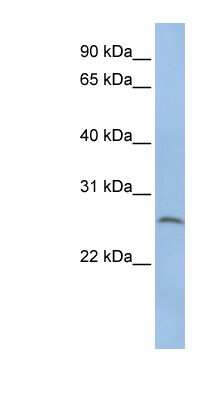 Western Blot: CELA1 Antibody [NBP1-56694] - HepG2 cell lysate, concentration 0.2-1 ug/ml.