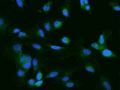 Immunocytochemistry/Immunofluorescence: CELSR2 Antibody [NBP2-98104] - Immunofluorescence staining of CELSR2 in U251MG cells. Cells were fixed with 4% PFA, permeabilzed with 0.1% Triton X-100 in PBS, blocked with 10% serum, and incubated with rabbit anti-Human CELSR2 polyclonal antibody (dilution ratio 1:200) at 4C overnight. Then cells were stained with the Alexa Fluor(R)488-conjugated Goat Anti-rabbit IgG secondary antibody (green) and counterstained with DAPI (blue).Positive staining was localized to Cytoplasm.