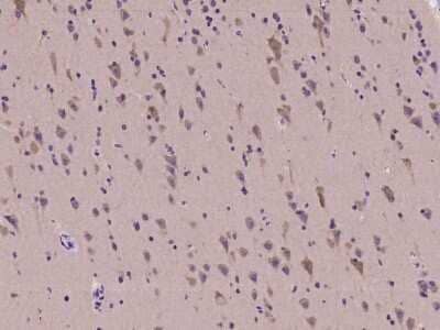 Immunohistochemistry-Paraffin: CELSR2 Antibody [NBP2-98104] - Immunochemical staining of human CELSR2 in human brain with rabbit polyclonal antibody at 1:100 dilution, formalin-fixed paraffin embedded sections.