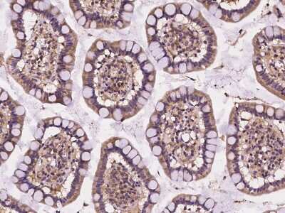 Immunohistochemistry-Paraffin: CELSR2 Antibody [NBP2-98104] - Immunochemical staining of human CELSR2 in human small intestine with rabbit polyclonal antibody at 1:100 dilution, formalin-fixed paraffin embedded sections.