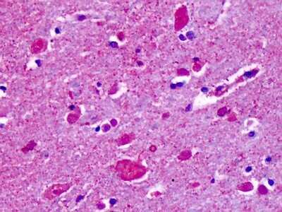 Immunohistochemistry-Paraffin: CELSR2 Antibody [NLS1939] - Analysis of anti-CELSR2 antibody with human brain, cortex, cerebellum at concentration 3-5 ug/ml.