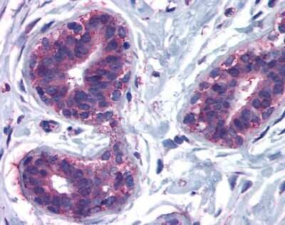 Immunohistochemistry-Paraffin: CELSR2 Antibody [NLS1940] - Analysis of anti-CELSR2 / EGFL2 antibody with human breast, lobular epithelium.