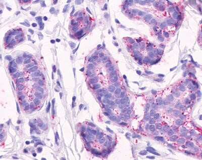 Immunohistochemistry-Paraffin: CELSR2 Antibody [NLS1942] - Analysis of anti-CELSR2 antibody with human breast, lobular epithelium 8 ug/ml.