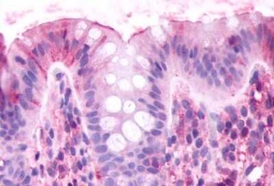 Immunohistochemistry-Paraffin: CELSR2 Antibody [NLS1942] - Anti-CELSR2 antibody IHC of human colon. Immunohistochemistry of formalin-fixed, paraffin-embedded tissue after heat-induced antigen retrieval.