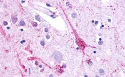 Immunohistochemistry-Paraffin: CELSR2 Antibody [NLS1942] - Anti-CELSR2 antibody IHC of human brain, cortex. Immunohistochemistry of formalin-fixed, paraffin-embedded tissue after heat-induced antigen retrieval.