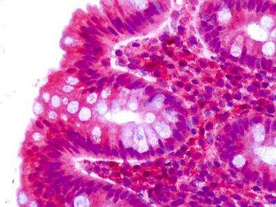 Immunohistochemistry-Paraffin: CELSR2 Antibody [NLS1943] - Analysis of anti-CELSR2 antibody with human, colon, epithelium.