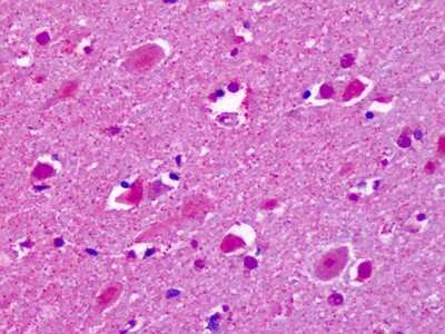 Immunohistochemistry-Paraffin: CELSR2 Antibody [NLS1943] - Analysis of anti-CELSR2 antibody with human brain, cortex, neurons at dilution 7 ug/ml.