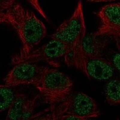 Immunocytochemistry/Immunofluorescence: CEMP1 Antibody [NBP3-17226] - Staining of human cell line SK-MEL-30 shows localization to nucleoplasm.