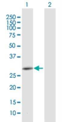 Western Blot: CEMP1 Antibody [H00752014-B01P-50ug] - analysis of CEMP1 expression in transfected 293T cell line (H00752014-T01) by CEMP1 MaxPab polyclonal antibody.Lane 1: CEMP1 transfected lysate(27.17 KDa).Lane 2: Non-transfected lysate.