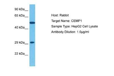 Western Blot: CEMP1 Antibody [NBP2-84645] - Host: Rabbit. Target Name: CEMP1. Sample Tissue: Human HepG2 Whole Cell. Antibody Dilution: 1ug/ml