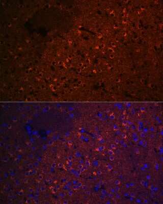 Immunocytochemistry/Immunofluorescence: CEND1 Antibody (1D3Z1) [NBP3-16614] - Immunofluorescence analysis of rat brain cells using CEND1 Rabbit mAb (NBP3-16614) at dilution of 1:100 (40x lens). Blue: DAPI for nuclear staining.