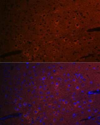 Immunocytochemistry/Immunofluorescence: CEND1 Antibody (1D3Z1) [NBP3-16614] - Immunofluorescence analysis of mouse brain cells using CEND1 Rabbit mAb (NBP3-16614) at dilution of 1:100 (40x lens). Blue: DAPI for nuclear staining.