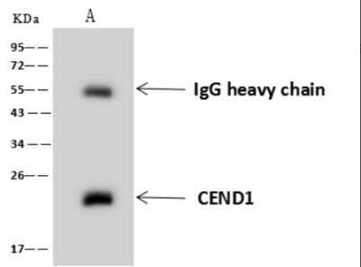 Immunoprecipitation: CEND1 Antibody [NBP3-06496] - Lane A:0.5 mg SH-SY5Y Whole Cell Lysate4 uL anti-CEND1 rabbit polyclonal antibody and 60 ug of Immunomagnetic beads Protein A/G.Primary antibody:Anti-CEND1 rabbit polyclonal antibody,at 1:100 dilution Secondary antibody:Goat Anti-Rabbit IgG (H+L)/HRP at 1/10000 dilutionDeveloped using the ECL technique.Performed under reducing conditions.Predicted band size: 22 kDaObserved band size :22 kDa