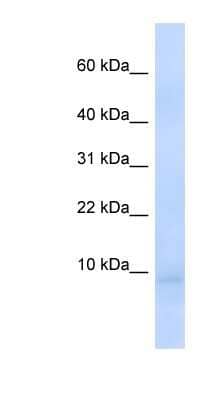Western Blot: CEND1 Antibody [NBP1-70495] - Human Liver cell lysate, concentration 0.2-1 ug/ml.