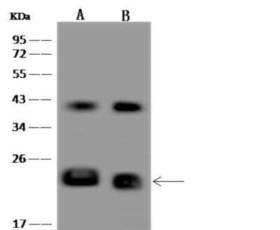 Western Blot: CEND1 Antibody [NBP3-06496] - Lane A: SH-SY5Y Whole Cell LysateLane B: U-87 MG Whole Cell LysateLysates/proteins at 30 ug per lane.SecondaryGoat Anti-Rabbit IgG (H+L)/HRP at 1/10000 dilution.Developed using the ECL technique.Performed under reducing conditions.Predicted band size:15 kDaObserved band size: kDa