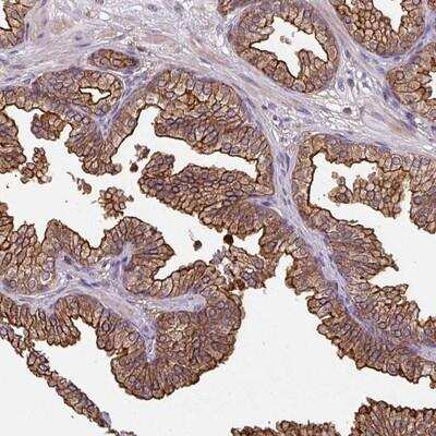 Immunohistochemistry-Paraffin: CENPBD1 Antibody [NBP2-14771] - Staining of human prostate shows strong membranous positivity in glandular cells.