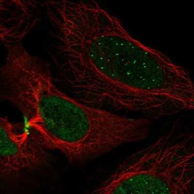 Immunocytochemistry/Immunofluorescence: CENPC Antibody [NBP2-55474] - Staining of human cell line U-2 OS shows localization to nucleoplasm, nuclear bodies, cytokinetic bridge, midbody, midbody ring & cleavage furrow.