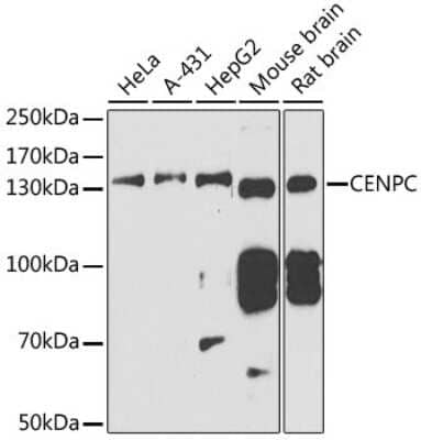 Western Blot: CENPC Antibody [NBP2-92795] - Analysis of extracts of various cell lines, using CENPC at 1:1000 dilution.Secondary antibody: HRP Goat Anti-Rabbit IgG (H+L) at 1:10000 dilution.Lysates/proteins: 25ug per lane.Blocking buffer: 3% nonfat dry milk in TBST.Detection: ECL Basic Kit .Exposure time: 90s.