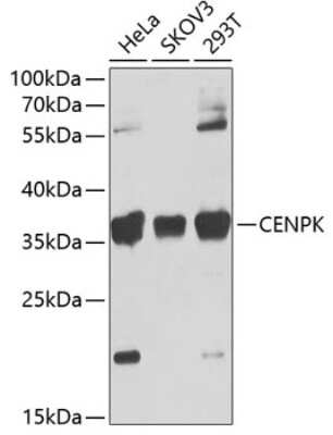 Western Blot: CENPK Antibody [NBP2-92676] - Analysis of extracts of various cell lines, using CENPK at 1:1000 dilution.Secondary antibody: HRP Goat Anti-Rabbit IgG (H+L) at 1:10000 dilution.Lysates/proteins: 25ug per lane.Blocking buffer: 3% nonfat dry milk in TBST.Detection: ECL Basic Kit .Exposure time: 30s.