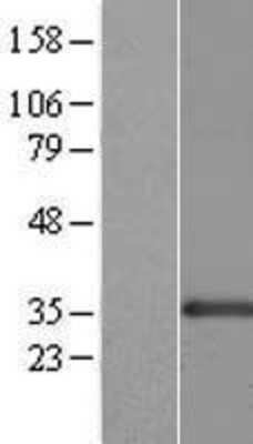 Western Blot: CENPK Overexpression Lysate (Adult Normal) [NBL1-09086] Left-Empty vector transfected control cell lysate (HEK293 cell lysate); Right -Over-expression Lysate for CENPK.