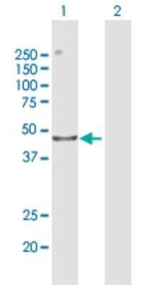 Western Blot: CENPL Antibody [H00091687-B02P] - Analysis of CENPL expression in transfected 293T cell line by CENPL polyclonal antibody.  Lane 1: CENPL transfected lysate(43.70 KDa). Lane 2: Non-transfected lysate.