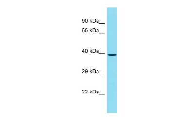 Western Blot: CENPL Antibody [NBP2-84650] - Host: Rabbit. Target Name: CENPL. Sample Type: HT1080 Whole Cell lysates. Antibody Dilution: 1.0ug/ml