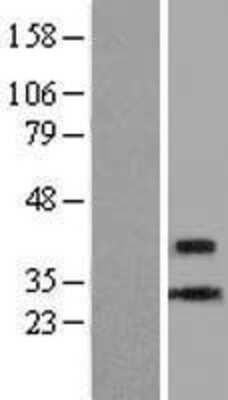 Western Blot: CENPL Overexpression Lysate (Adult Normal) [NBL1-09087] Left-Empty vector transfected control cell lysate (HEK293 cell lysate); Right -Over-expression Lysate for CENPL.