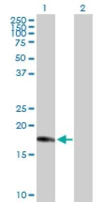 Western Blot: CENPM Antibody [H00079019-D01P] - Analysis of CENPM expression in transfected 293T cell line by CENPM polyclonal antibody.Lane 1: CENPM transfected lysate(19.70 KDa).Lane 2: Non-transfected lysate.