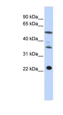 Western Blot CENPM Antibody - BSA Free