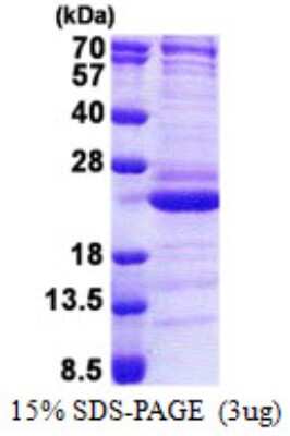 SDS-Page: CENPM Protein [NBP2-22766]