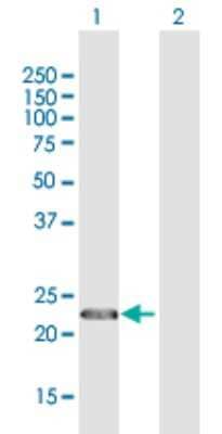 Western Blot: CENPN Antibody [H00055839-D01P] - Analysis of CENPN expression in transfected 293T cell line by CENPN polyclonal antibody.Lane 1: CENPN transfected lysate(24.10 KDa).Lane 2: Non-transfected lysate.