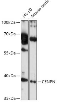 Western Blot: CENPN Antibody [NBP2-92377] - Analysis of extracts of various cell lines, using CENPN at 1:1000 dilution.Secondary antibody: HRP Goat Anti-Rabbit IgG (H+L) at 1:10000 dilution.Lysates/proteins: 25ug per lane.Blocking buffer: 3% nonfat dry milk in TBST.Detection: ECL Basic Kit .Exposure time: 10s.