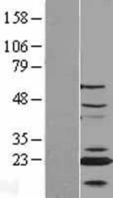 Western Blot: CENPN Overexpression Lysate (Adult Normal) [NBL1-09089] Left-Empty vector transfected control cell lysate (HEK293 cell lysate); Right -Over-expression Lysate for CENPN.