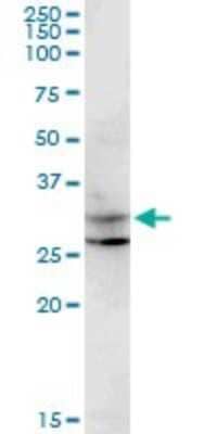 Western Blot: CENPP Antibody (3G8) [H00401541-M07] - Analysis of CENPP expression in K-562.