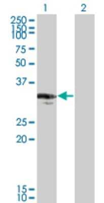 Western Blot: CENPP Antibody (3G8) [H00401541-M07] - Analysis of CENPP expression in transfected 293T cell line by CENPP monoclonal antibody (M07), clone 3G8. Lane 1: CENPP transfected lysatE (33.165 KDa). Lane 2: Non-transfected lysate.