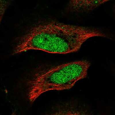 Immunocytochemistry/Immunofluorescence: CENPP Antibody [NBP2-58596] - Staining of human cell line U-2 OS shows localization to nucleus & nucleoli.