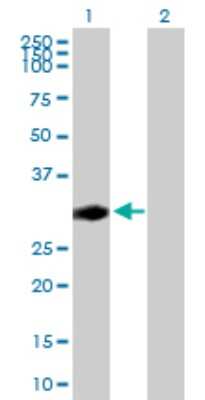 Western Blot: CENPP Antibody [H00401541-B01P] - Analysis of CENPP expression in transfected 293T cell line by CENPP polyclonal antibody.  Lane 1: CENPP transfected lysate(31.68 KDa). Lane 2: Non-transfected lysate.