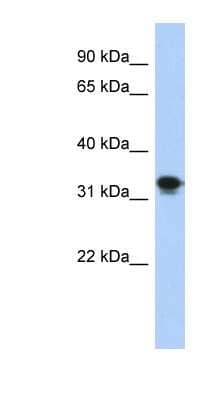 Western Blot: CENPP Antibody [NBP1-53064] - Transfected 293T cell lysate, concentration 0.2-1 ug/ml.